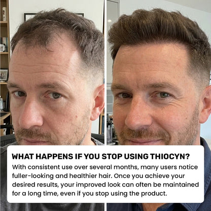 Thiocyn™ - Hair Nutrient Capsules