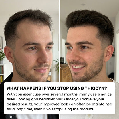 Thiocyn™ - Hair Root Serum