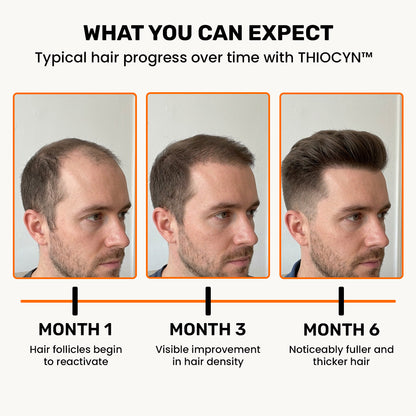 Thiocyn™ - Hair Nutrient Capsules