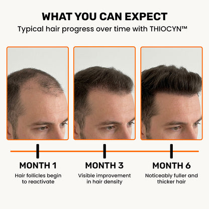 Thiocyn™ - Hair Root Serum