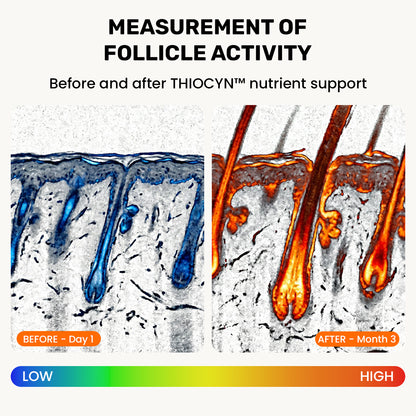 Thiocyn™ - Hair Nutrient Capsules