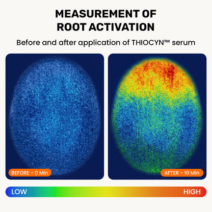 Thiocyn™ - Hair Root Serum